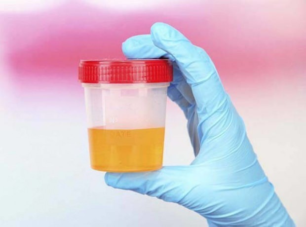 Test de grossesse avec de l'urine