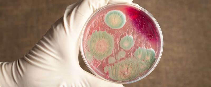 Qu'est-ce que l'anthrax et comment se transmet l'anthrax? Les experts mettent en garde