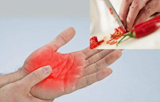 comment se débarrasser de la douleur au poivre dans la main
