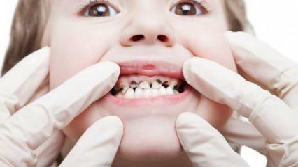 Faites faire les soins dentaires de votre enfant pendant le semestre !
