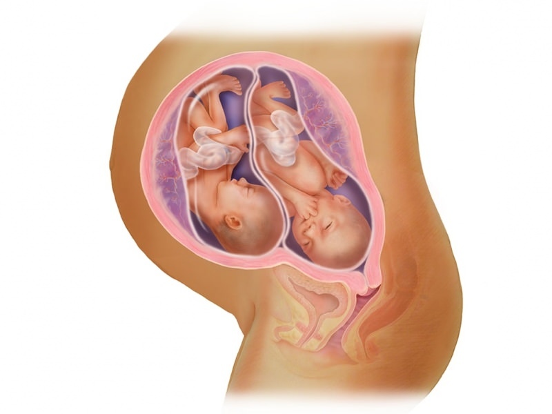 Grossesse jumelle en FIV! Qu'est-ce que le transfert d'embryons?