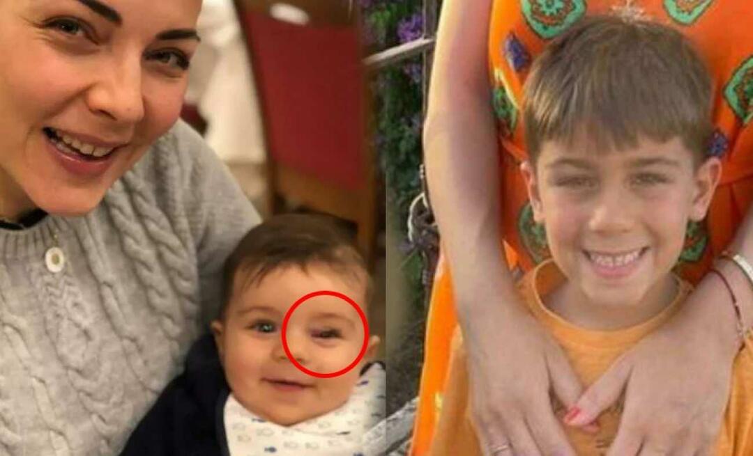 Burcu Kara a annoncé la maladie de son fils! Le gonflement de votre œil est le signe d’une tumeur…