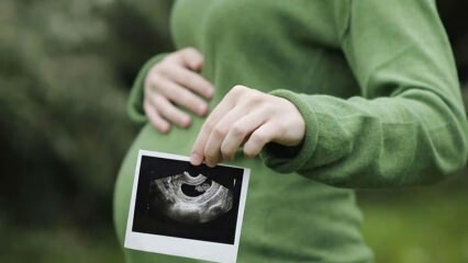 Quand est le sexe du bébé au plus tôt et définitivement? Qui détermine le sexe?