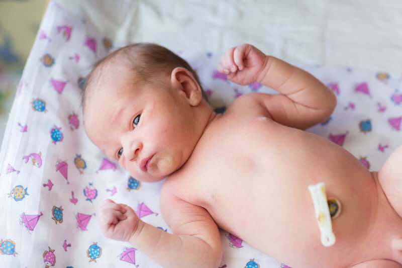 Coupe tardive du cordon ombilical chez les bébés