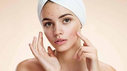 Les pilules contre l'acné sont-elles nocives?