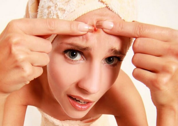 L'acné cause-t-elle des maux de tête? Que faire contre les boutons douloureux? Douleur due à l'acné ...