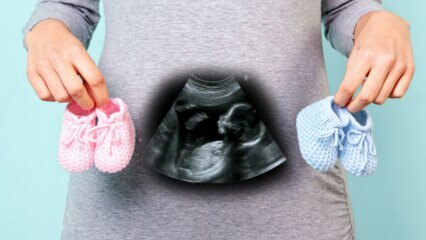 Le sexe du bébé sera-t-il déterminé au cours du premier trimestre de la grossesse?