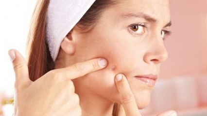 Quelles sont les acné qui ne devraient pas s'ennuyer?