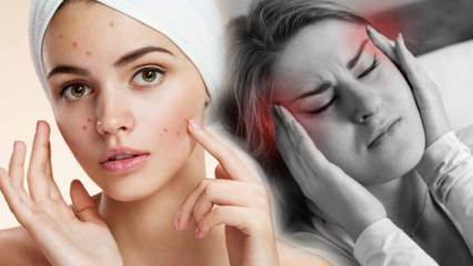 L'acné cause-t-elle des maux de tête? Que faire contre l'acné douloureuse? Douleur due à l'acné ...