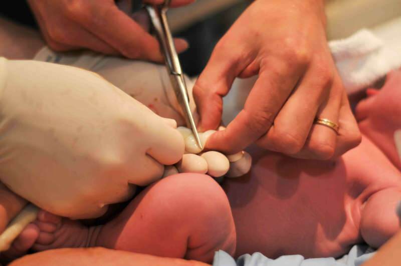 Quand faut-il couper le cordon ombilical chez les bébés?
