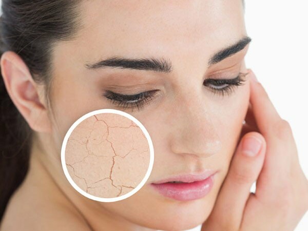 Conseils pour les soins de la peau sèche