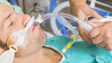 Quelle est l'intubation que Fahrettin Koca a dite? Qu'est-ce que cela signifie d'intuber un patient? Le patient intubé va-t-il récupérer?