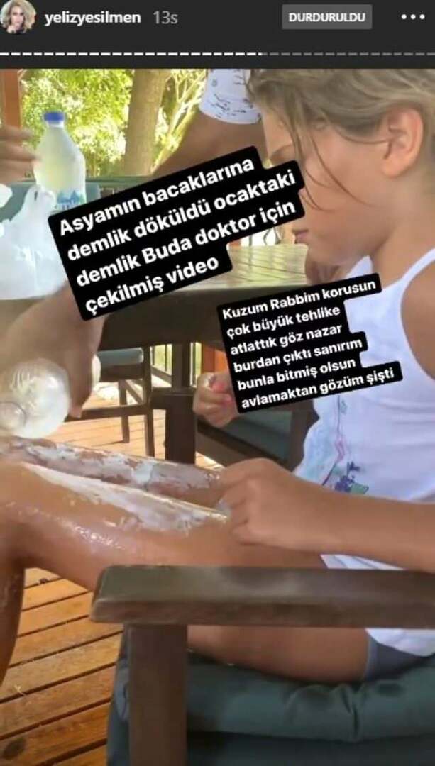 De l'eau bouillante a été versée sur les jambes de la fille de Yeliz Yeşilmen