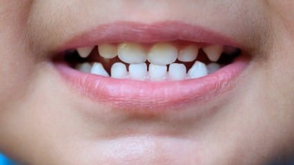 Comment enseigner les soins dentaires aux enfants?