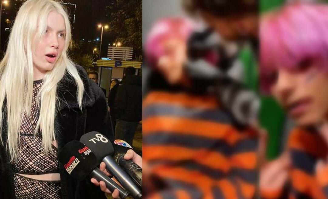 Aleyna Fox a déclaré à la maltraitance des enfants: Le jeune homme qui s'est tatoué le visage pour 500 TL est devenu l'agenda !