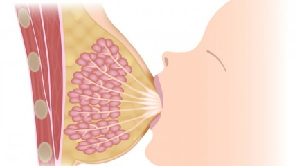 Qu'est-ce que la mammite (inflammation du sein)? Symptômes et traitement de la mammite pendant l'allaitement