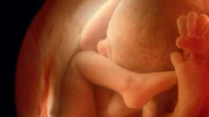 Ne pas montrer le sexe du bébé à l'échographie! À quoi ressemblent les bébés garçons et filles à l'échographie?
