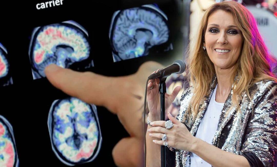 Qu'est-ce que le syndrome de la personne raide? Quelle est la maladie de Céline Dion ?