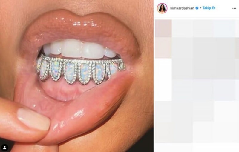 Le bijou dentaire de 5000 $ de Kim Kardashian