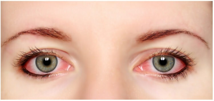 Le mascara et l'eye-liner sont-ils allergiques aux yeux?