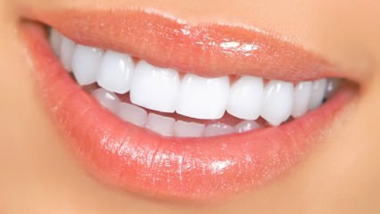 Méthodes de blanchiment des dents naturelles