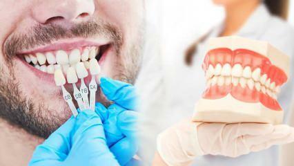 Pourquoi le placage de zirconium est-il appliqué sur les dents? Quelle est la durabilité du revêtement de zirconium ?