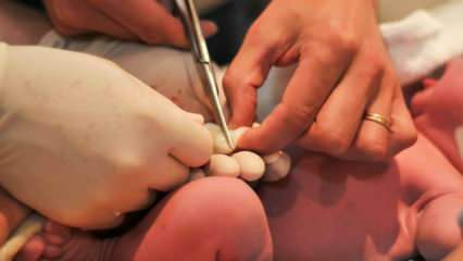 Quand le cordon ombilical est-il coupé chez les bébés? Avantages de couper le cordon ombilical tardivement