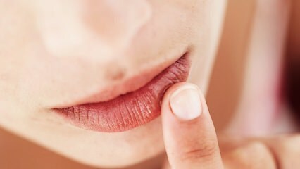 Comment devraient être les soins des lèvres pendant la grossesse?