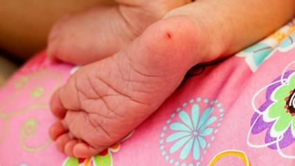 Pourquoi le sang du talon est-il prélevé chez les nourrissons? Exigences pour les tests sanguins du talon chez les nourrissons