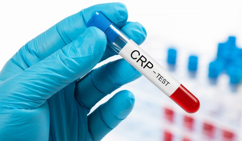 Pourquoi la CRP dans le sang monte-t-elle? Qu'est-ce que CRP? Comment faire baisser le CRP?