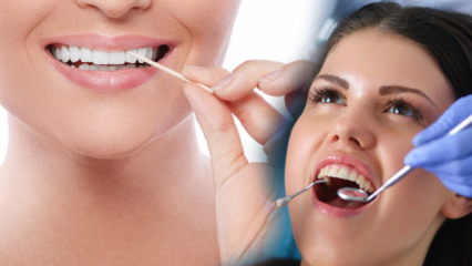 Comment la santé bucco-dentaire est-elle protégée? Quelles sont les choses à considérer lors du nettoyage des dents?