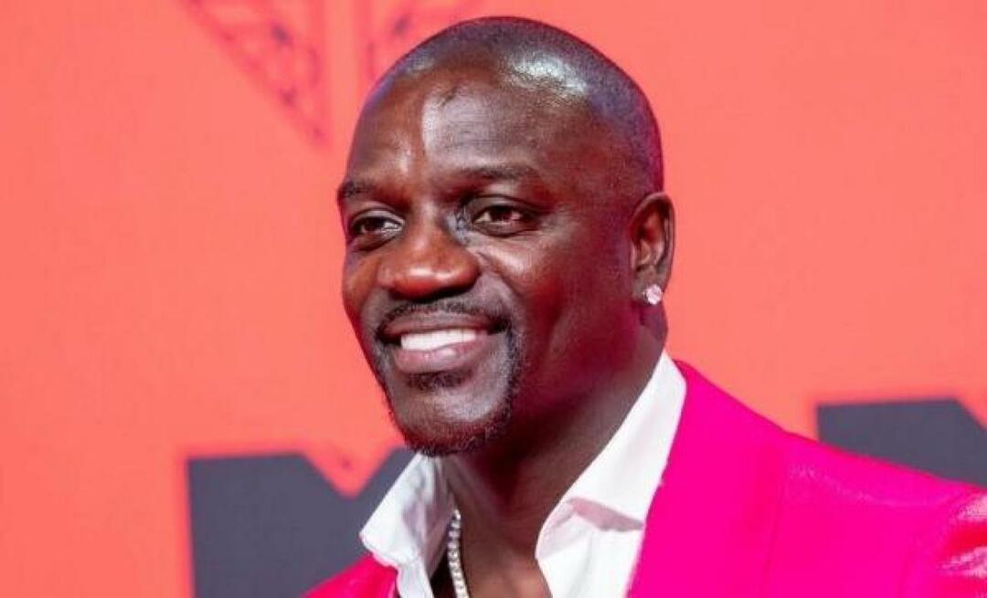 Le chanteur américain Akon a également préféré la Turquie pour la greffe de cheveux! Voici le prix qu'il a payé...
