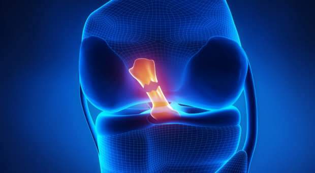 Quelles sont les causes de la rupture du ligament croisé et quels sont les symptômes? Existe-t-il un traitement du ligament croisé?