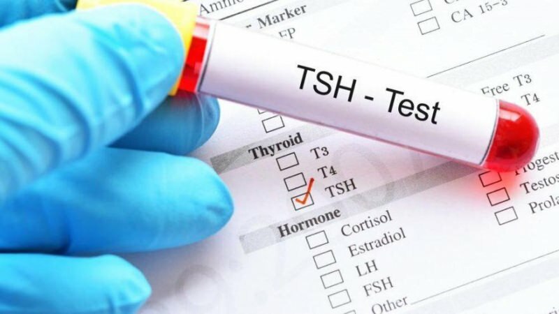 Qu'est-ce que le test TSH? Quels sont les symptômes de la TSH? Que signifie TSH haut et bas?