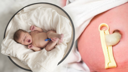 Qu'est-ce que Placenta Previa? Comment faire les soins du cordon ombilical chez les bébés? Si le cordon ombilical est long ...