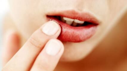 Qu'est-ce qui est bon pour le cracking des lèvres?