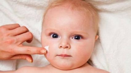 Conseils de soins de la peau pour les bébés! Quels sont les problèmes de peau chez les bébés?
