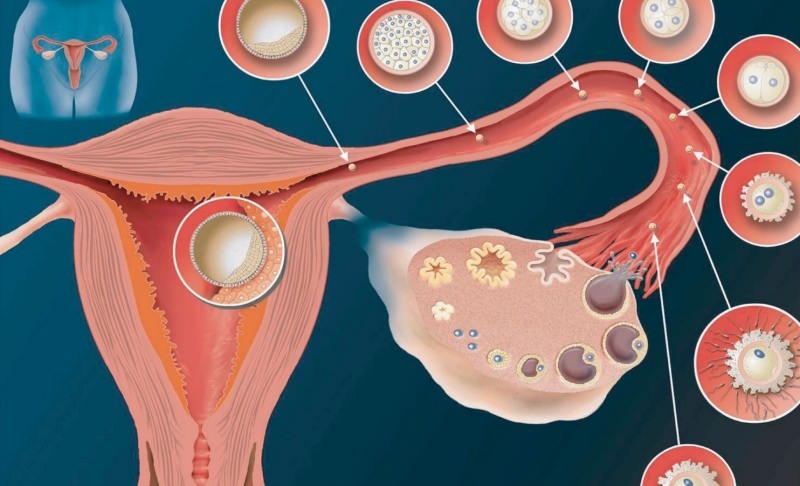 Qu'est-ce que l'implantation? Comment distinguer les saignements des saignements menstruels? Couleur et consistance ...