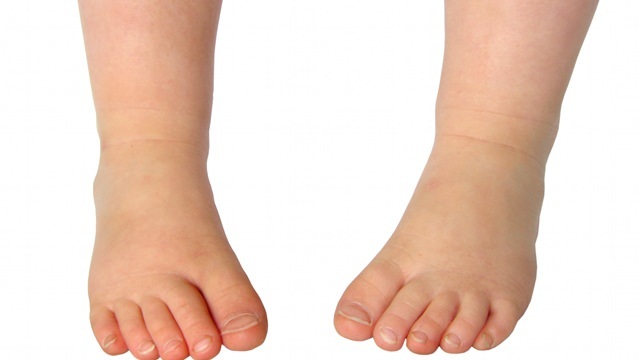 Les 3 problèmes les plus courants de la santé des pieds