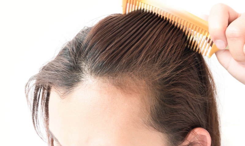 solutions de perte de cheveux après l'accouchement! Qu'est-ce qui est bon pour la perte de cheveux?