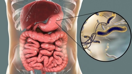 Qu'est-ce que Helicobacter Pylori (microbe de l'estomac)? Maladies causées par Helicobacter Pylori ...