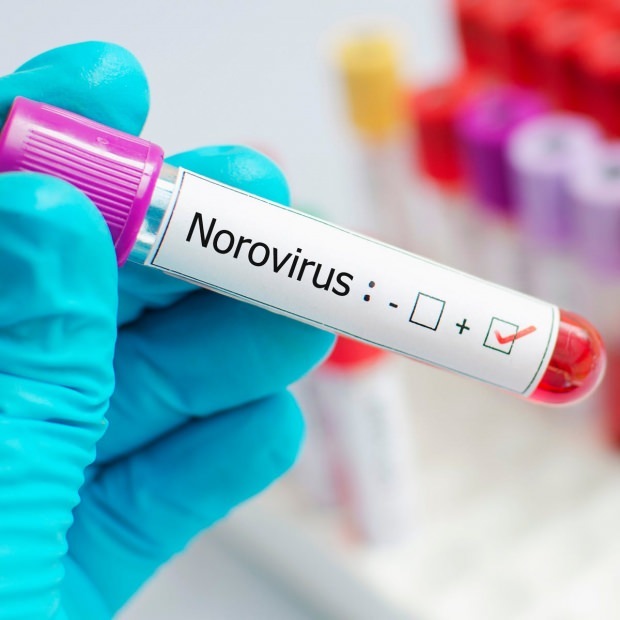 Qu'est-ce que le norovirus et quelles maladies