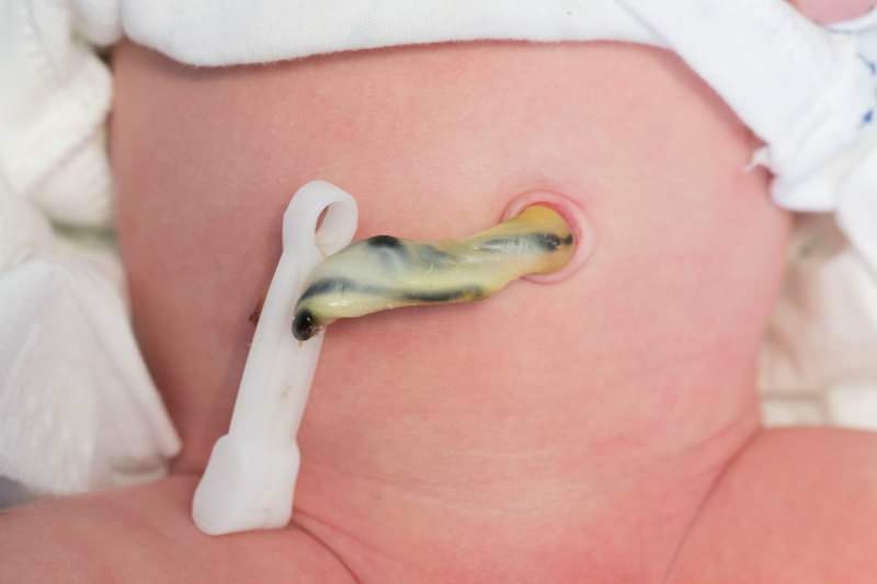 Quand le cordon ombilical tombe-t-il chez les bébés?