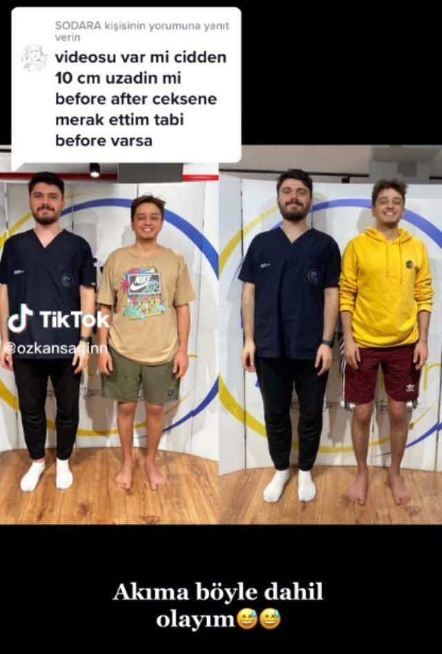 Özkan Sağın a fait avant et après la chirurgie