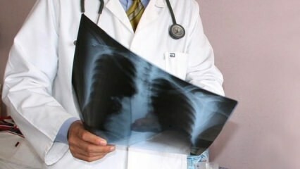 Des experts annoncés! Augmentation des décès par cancer du poumon