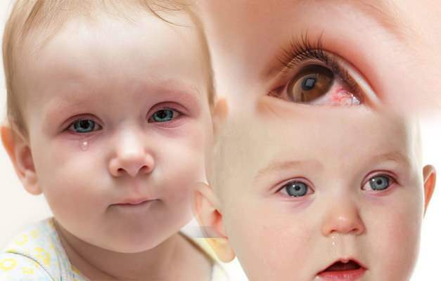 Pourquoi les yeux des bébés ont-ils du sang? Comment les saignements oculaires passent-ils chez un nouveau-né?
