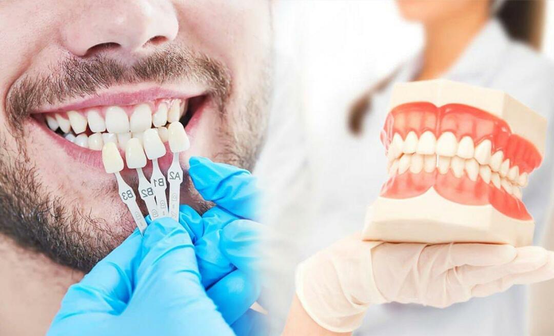 Pourquoi les couronnes en zirconium sont-elles appliquées sur les dents? Quelle est la durabilité du revêtement de zirconium ?