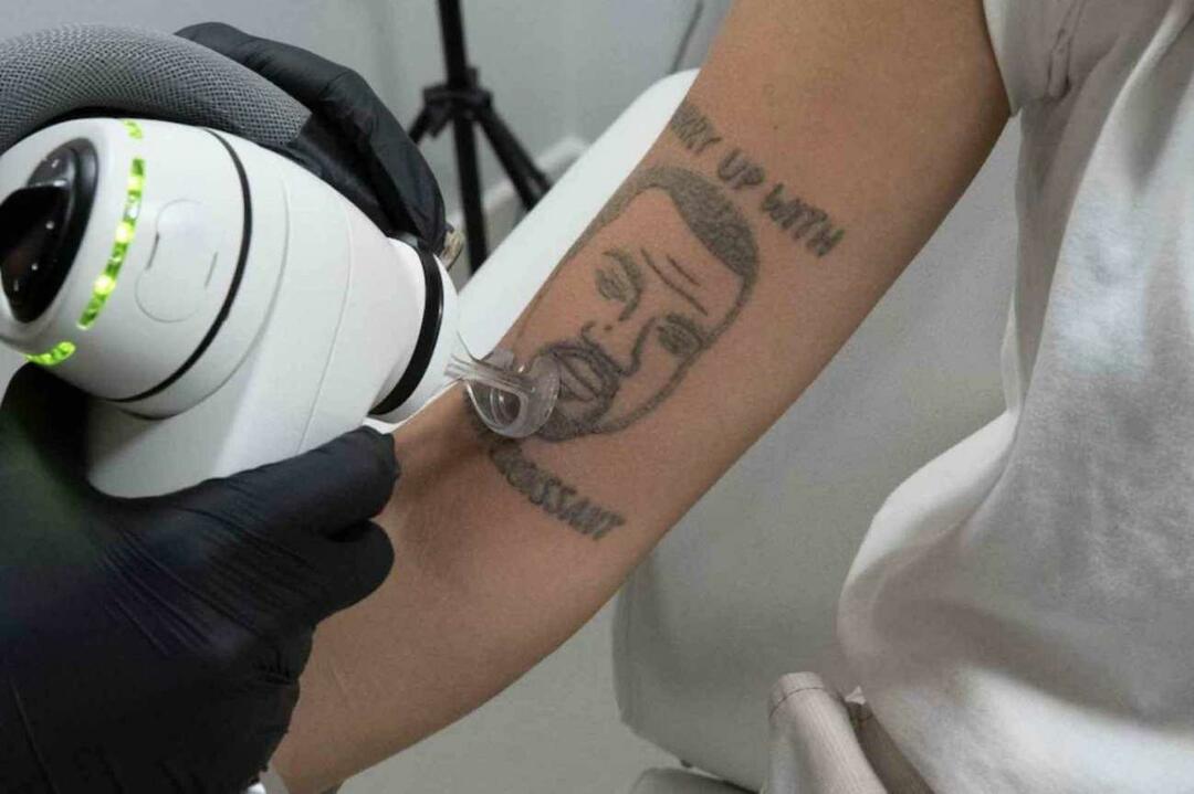 Service géant à ceux qui n'aiment pas Kanye West! La possibilité d'enlever son tatouage gratuitement a fait un gâchis