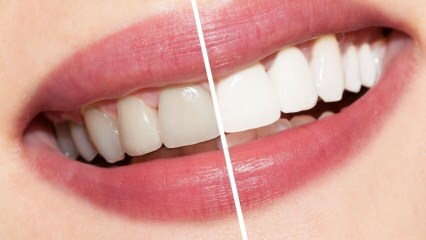 Quelles sont les recommandations pour les dents blanches? Le blanchiment des dents guérit naturellement à la maison ...