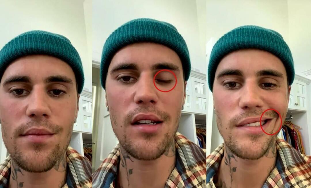 Justin Bieber a eu une paralysie faciale! La célèbre star ne peut plus repartir en tournée mondiale